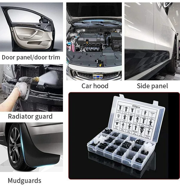 Universal Expansion Buckle Set(BUY 3 GET FREE SHIPPING)