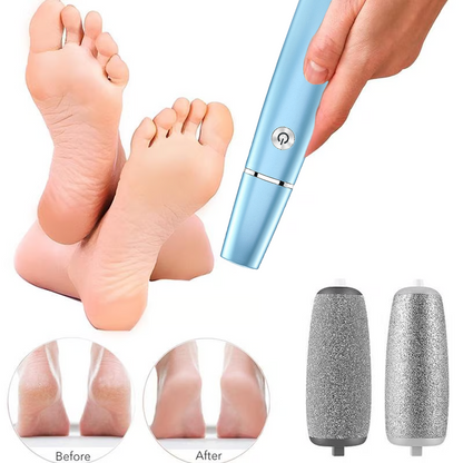 💕🌸Limited-time offer: 63% OFF🌸 Electric Foot Exfoliator⚡