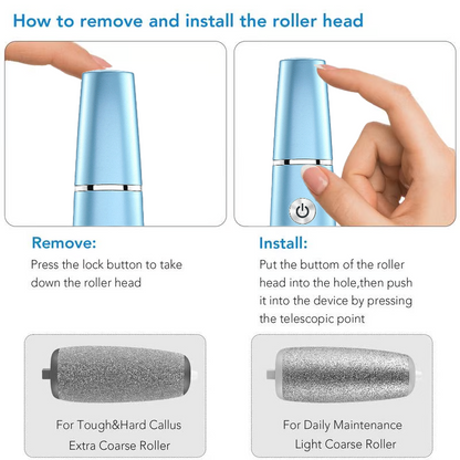 💕🌸Limited-time offer: 63% OFF🌸 Electric Foot Exfoliator⚡