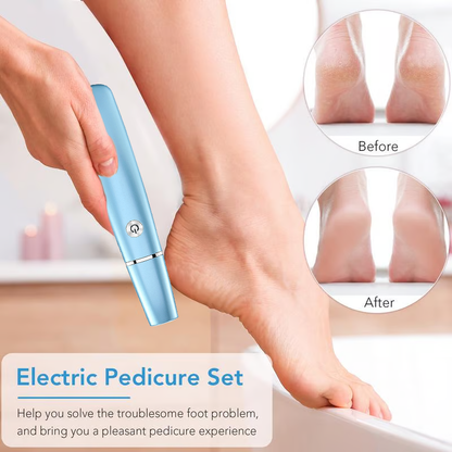 💕🌸Limited-time offer: 63% OFF🌸 Electric Foot Exfoliator⚡