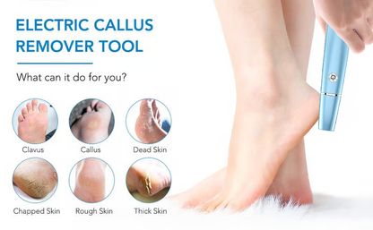 💕🌸Limited-time offer: 63% OFF🌸 Electric Foot Exfoliator⚡