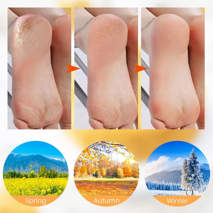 🔥🔥Get 3 items when you buy 1！✨️Enjoy a foot spa anytime anywhere！👣Moisturizing Foot Mask Exfoliating Silicone Socks Beach Protective Socks(3pcs)