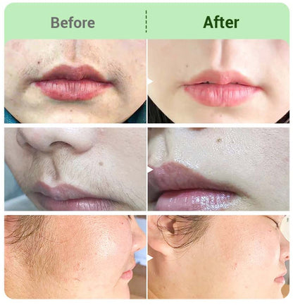 🔥 LAST DAY BUY 1 GET 2 FREE💛Hair Removal Cream Kit for Women