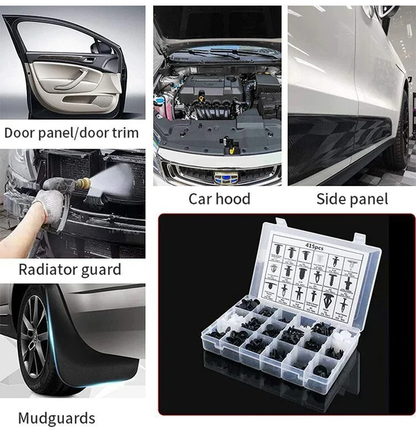 Universal Expansion Buckle Set(BUY 3 GET FREE SHIPPING)