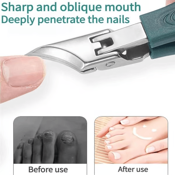 🔥Podiatrist-Recommended Nail Clippers - Ergonomic Angled Design for Toenails & Ingrowns
