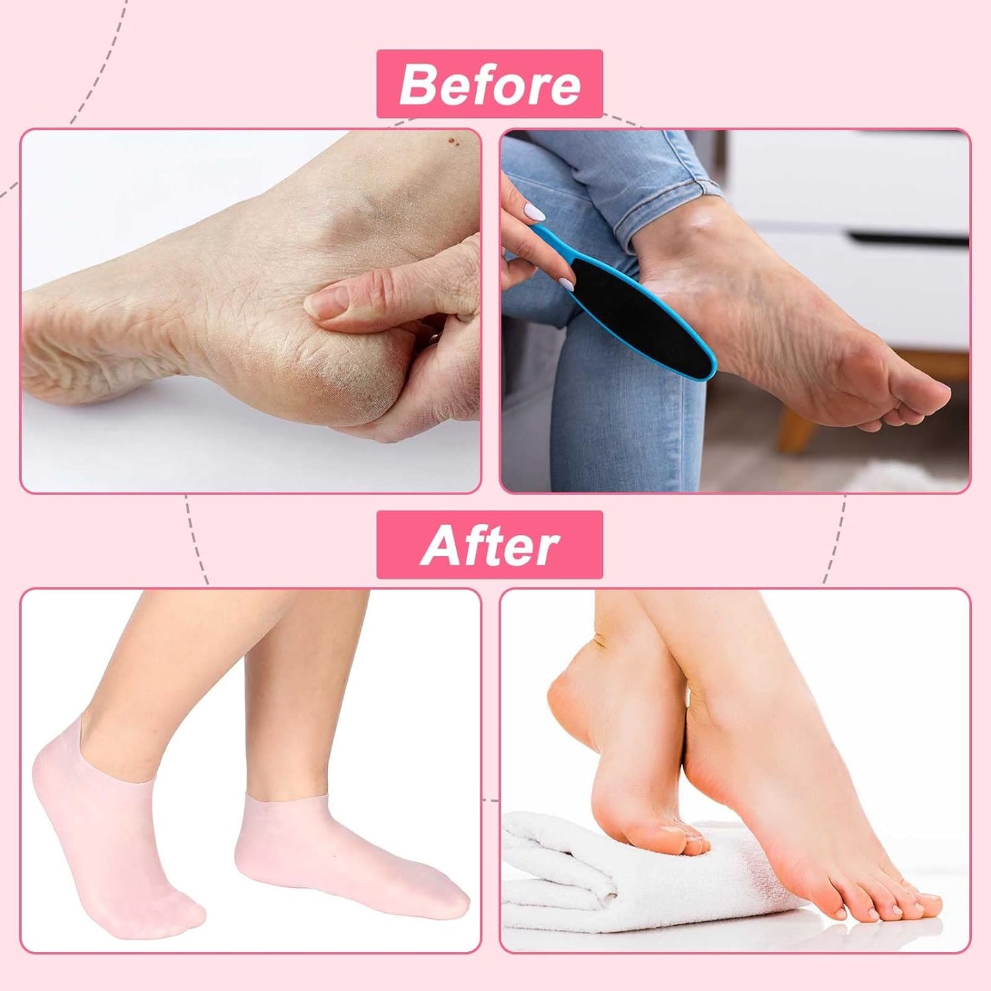 🔥🔥Get 3 items when you buy 1！✨️Enjoy a foot spa anytime anywhere！👣Moisturizing Foot Mask Exfoliating Silicone Socks Beach Protective Socks(3pcs)