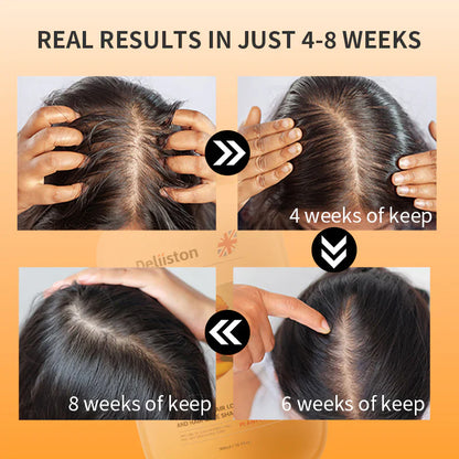 🧴Anti-Hair Loss Shampoo 💫