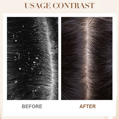 Dandruff Control & Soothing Shampoo