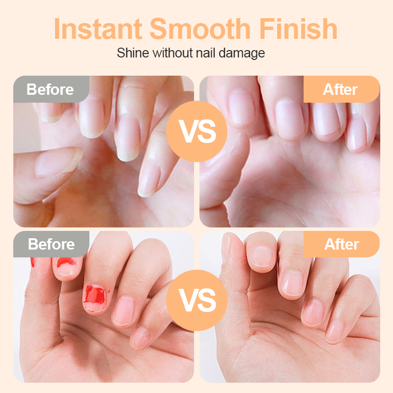 🔥2-in-1 Smart Electric Nail Trimmer & Polisher for All Ages 👨‍👩‍👧‍👦 – Blade-Free, Blood-Free & Stress-Free Nail Care! 💅