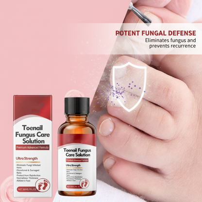 🔥Christmas Limited-Time Offer:64% OFF!!!🔥Nail Repair Essence for Damaged Nails