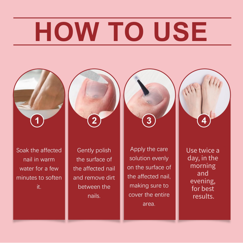 🔥Christmas Limited-Time Offer:64% OFF!!!🔥Nail Repair Essence for Damaged Nails