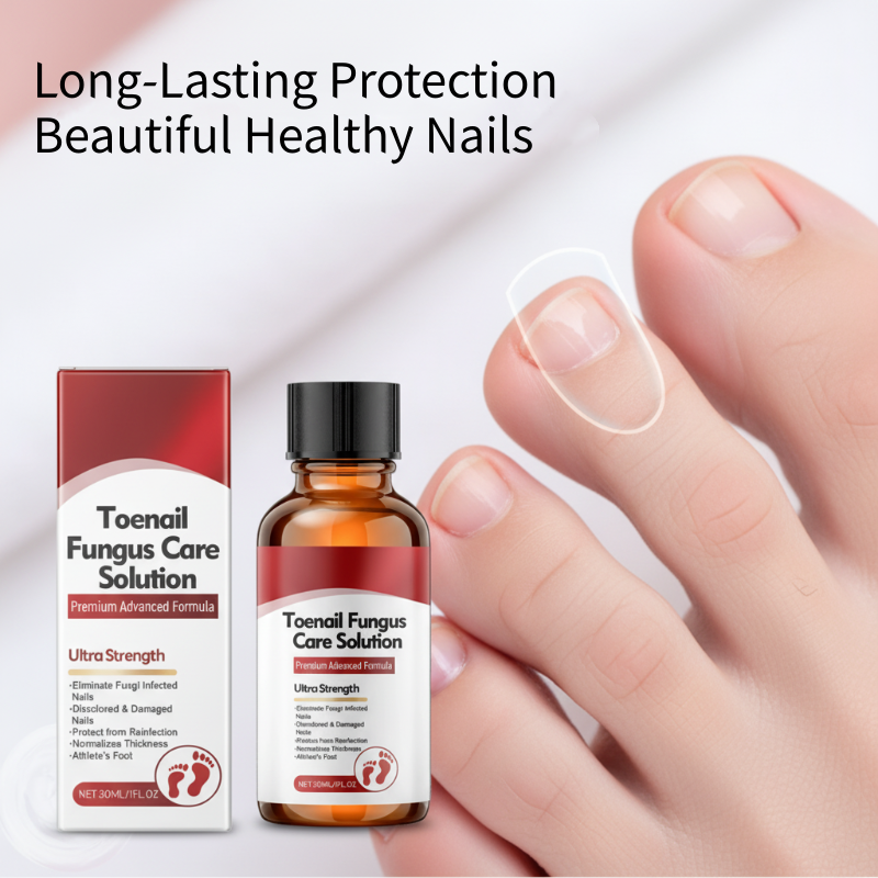 🔥Christmas Limited-Time Offer:64% OFF!!!🔥Nail Repair Essence for Damaged Nails