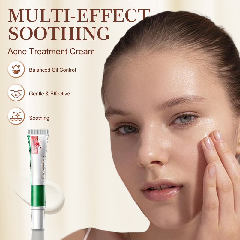Multi-Effect Soothing Acne Treatment Cream