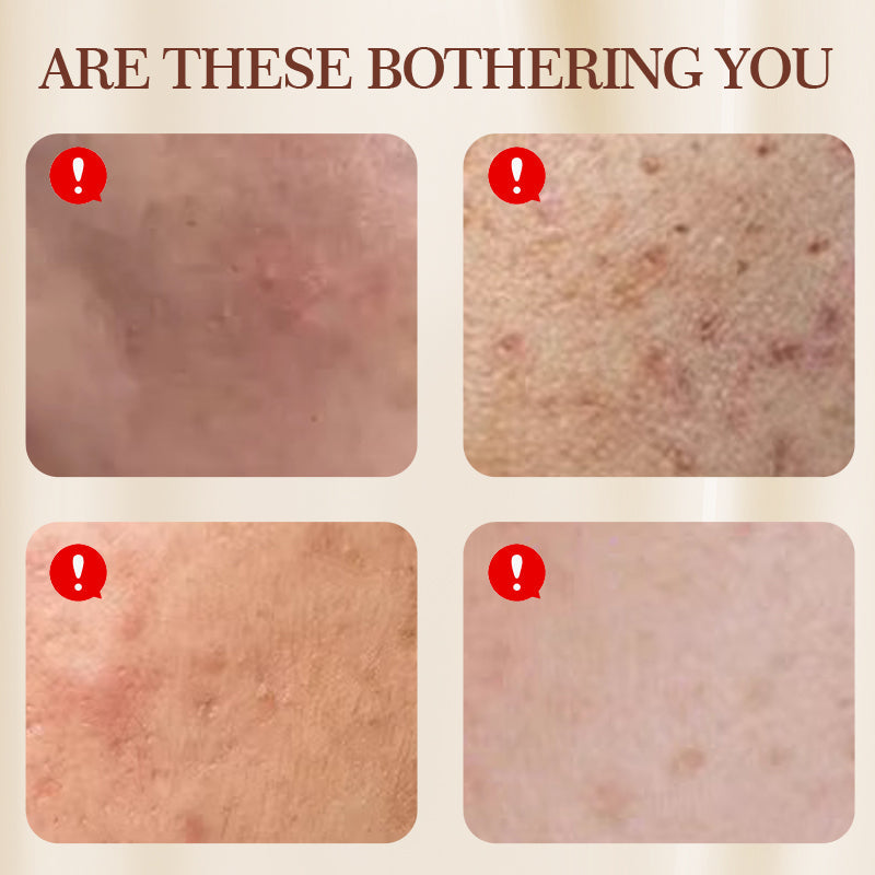 Multi-Effect Soothing Acne Treatment Cream