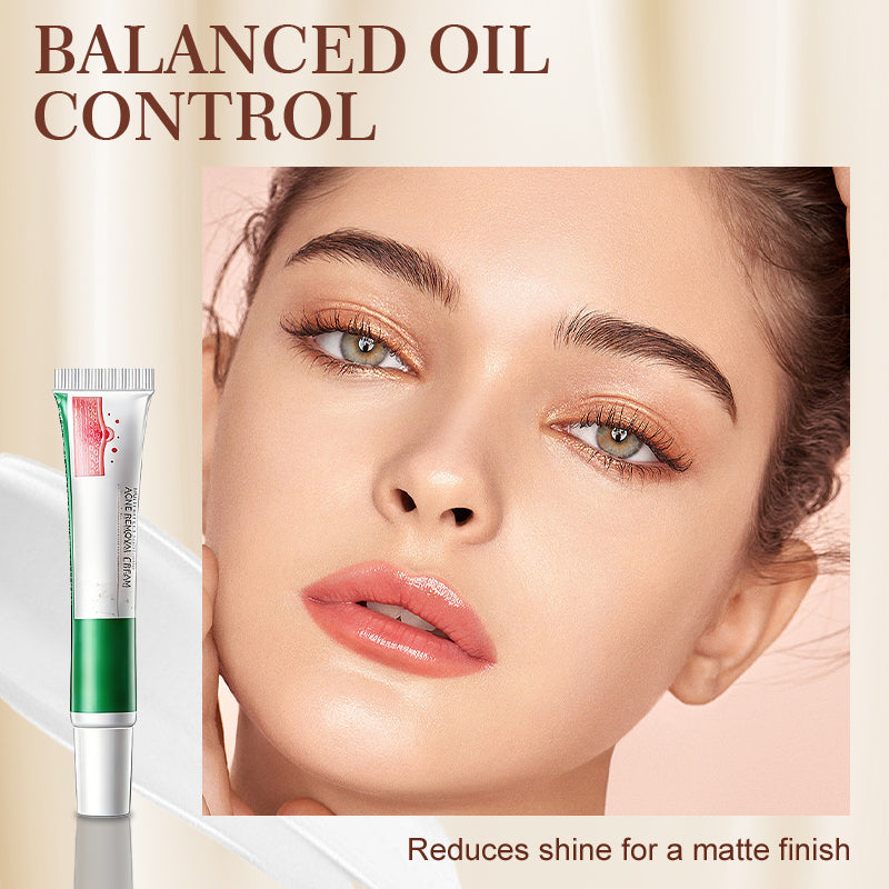 Multi-Effect Soothing Acne Treatment Cream