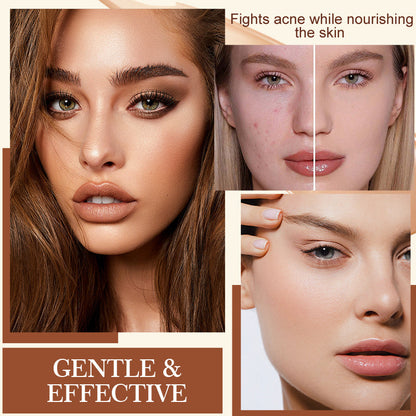 Multi-Effect Soothing Acne Treatment Cream