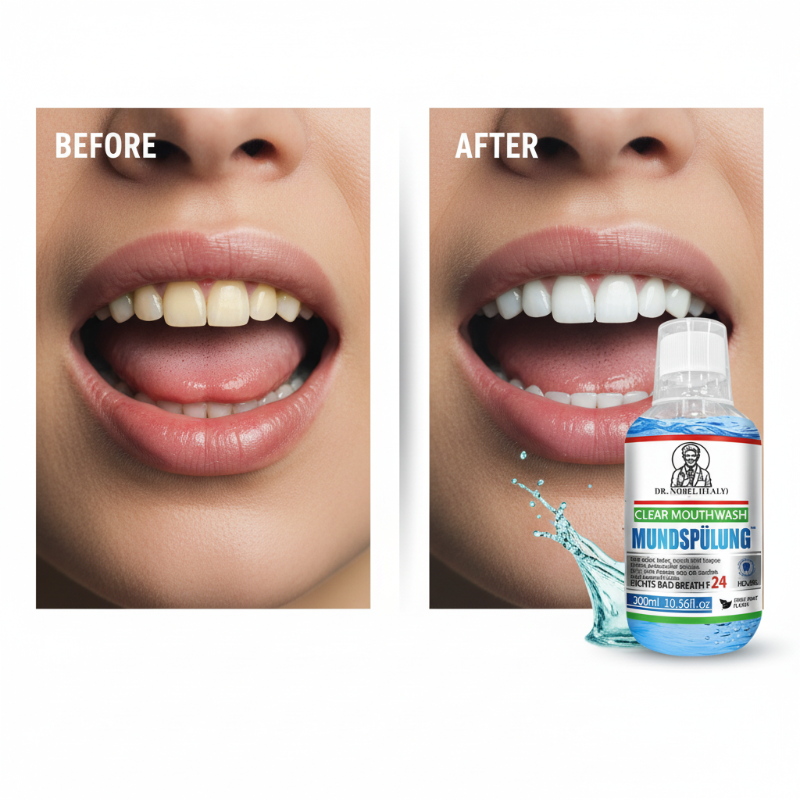 24-Hour Fresh Breath Mouthwash