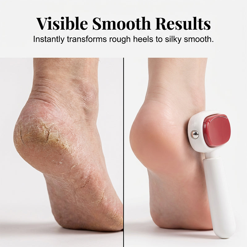 ⏳Time-Limited Special⏰Double-Sided Foot Scraper for Callus Removal