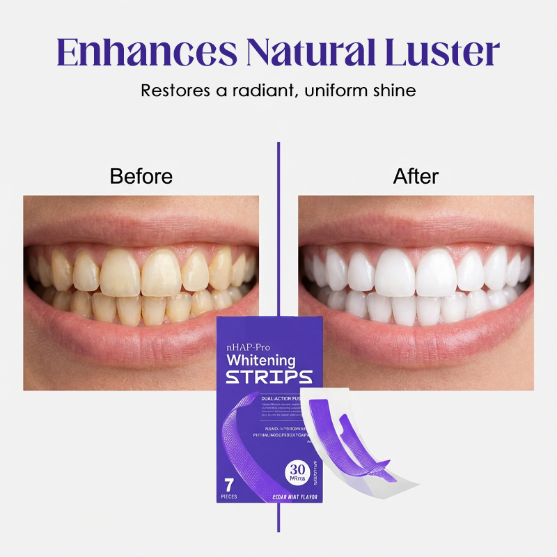 Professional At-Home Teeth Whitening Kit