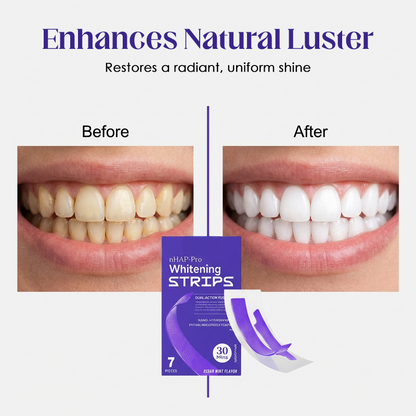 Professional At-Home Teeth Whitening Kit