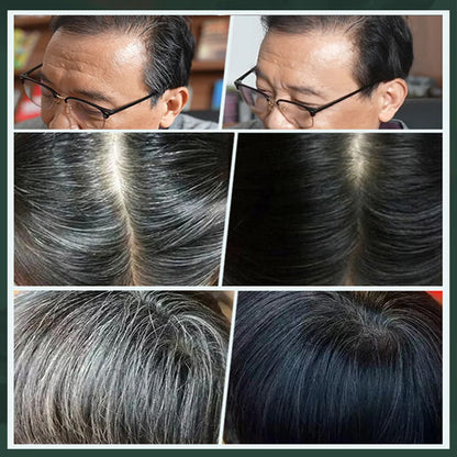 ✨ Premium Plant-Based Hair Dye for Salon-Perfect Roots – 100% Plant Power, Easy to Use & Covers Gray Hair in 5 Minutes 🌿