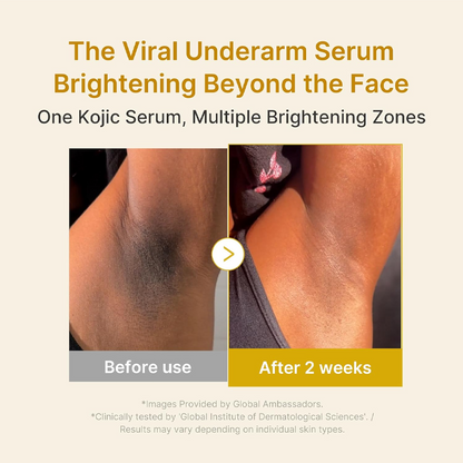 Kojic Acid Turmeric Brightening Serum