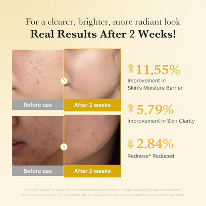 Kojic Acid Turmeric Brightening Serum