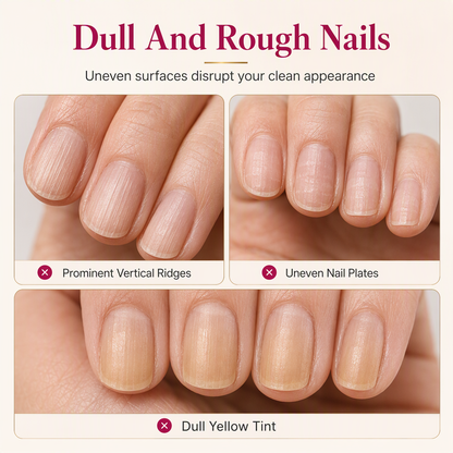 💅 Nail Ridge Smoothing Filler for a Natural Glossy Finish