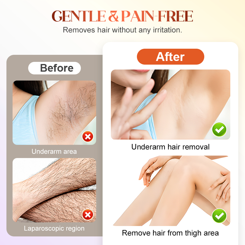Gentle Hair Removal Cream for Smooth & Silky Skin